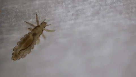How to treat head lice